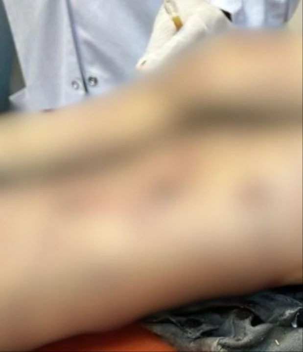 Köpek saldırısında ölümden dönmüştü! Minik Tunahan'ın çığlıkları yürekleri dağladı - 3. Resim