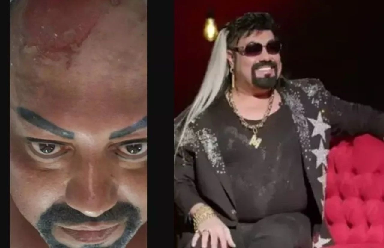 Kobra Murat'ın peruğu başına iş açtı! Konserlerini bile iptal etti - 1. Resim