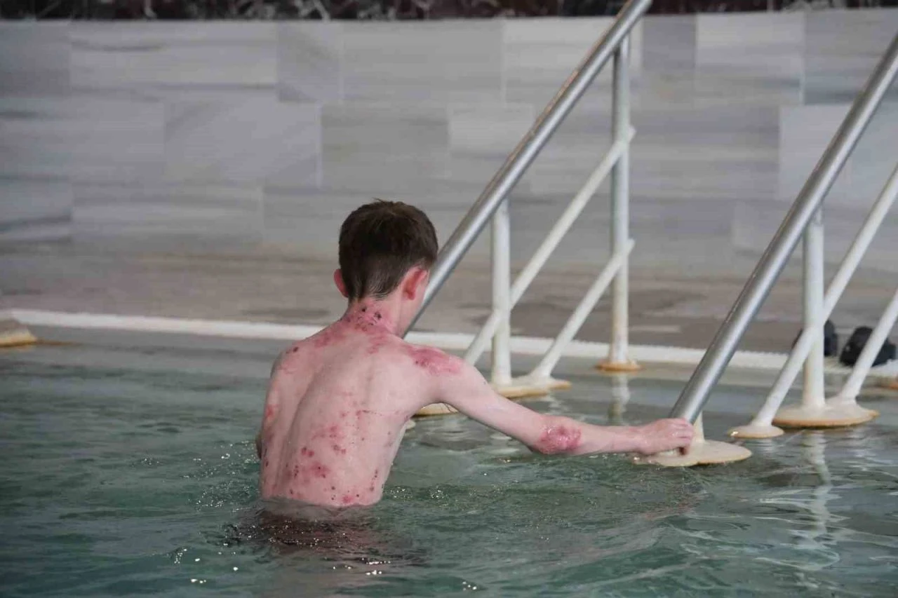 Vücudundaki dev ve derin yaralarla yıllarca yaşadı! Tedavisi olmayan hastalık termal suyla 20 günde geçti - 1. Resim