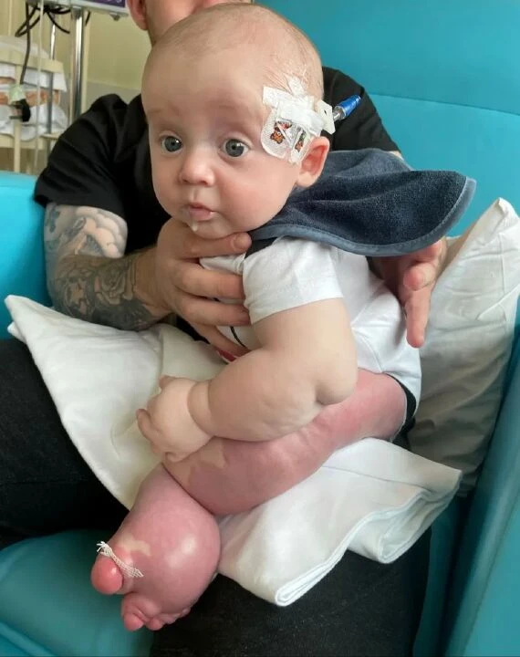 Dünyada sadece 200 kişide görülen hastalığa sahip: Çok büyük bir bacakla doğdu