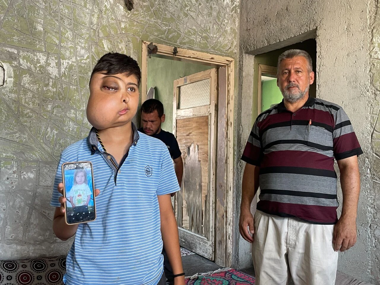 Milyonda bir görülüyor! İki farklı yüzü var