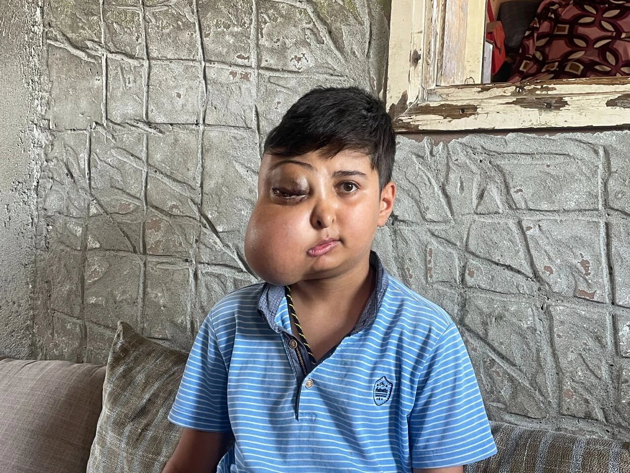 Milyonda bir görülüyor! İki farklı yüzü var