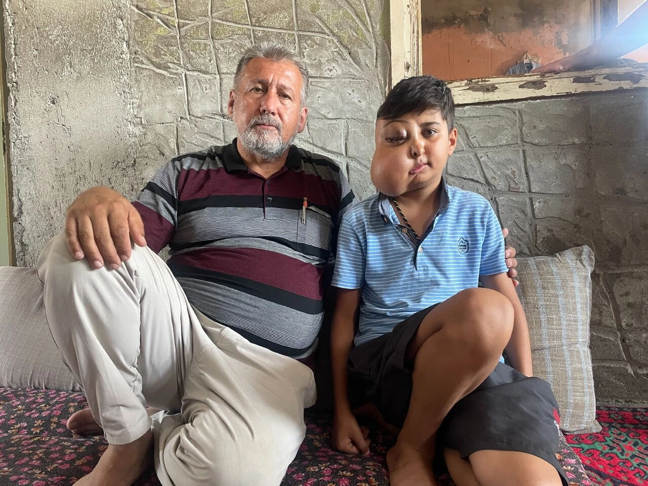 Milyonda bir görülüyor! İki farklı yüzü var