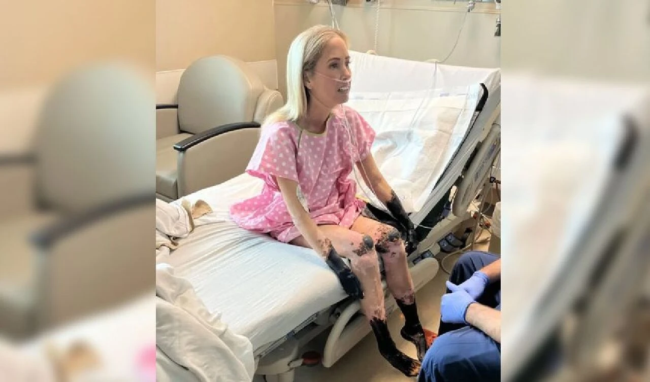 Soğuk algınlığı sandı, uzuvlarını kaybetti