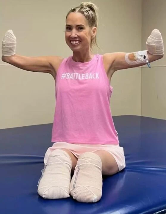 Grip olduğunu sandı hayatı karardı! Kol ve bacaklarını kestiler - 2. Resim