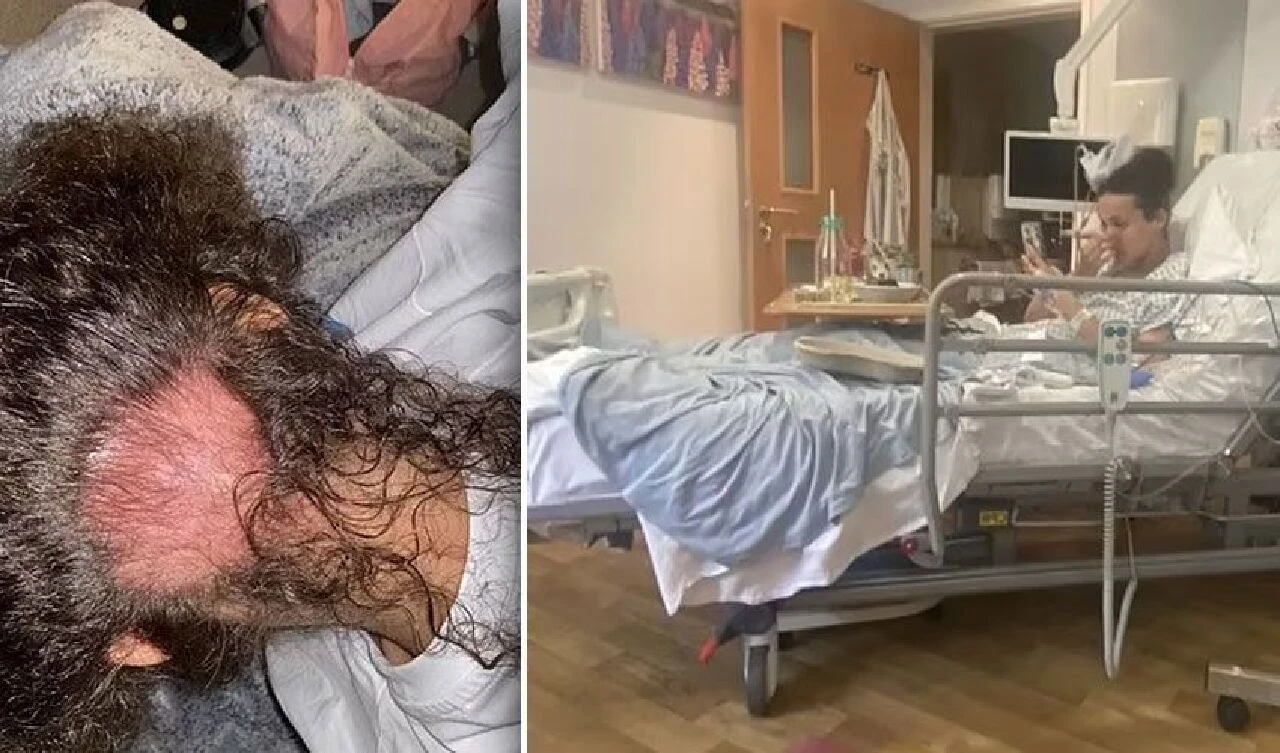 İdrar yolu enfeksiyonu teşhisi kondu kanser çıktı! Diş ve saçlarla sarılı tümör sonradan fark edildi - 2. Resim