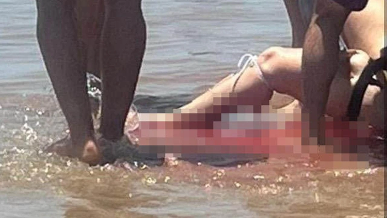 Deniz kana bulandı! Köpek balığı, kadının bacağının yarısını kopardı: İşte korkunç görüntüler