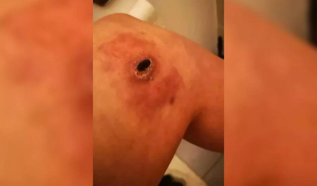 Telefonunu şarja takıp yanına aldı, uyandığında gözlerine inanamadı! Sosyal medya bu görüntüyü konuşuyor - 1. Resim