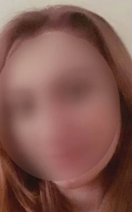 Ankara'da bir garip dava! Eşine kezzapla yaraladı serbest kaldı - 2. Resim