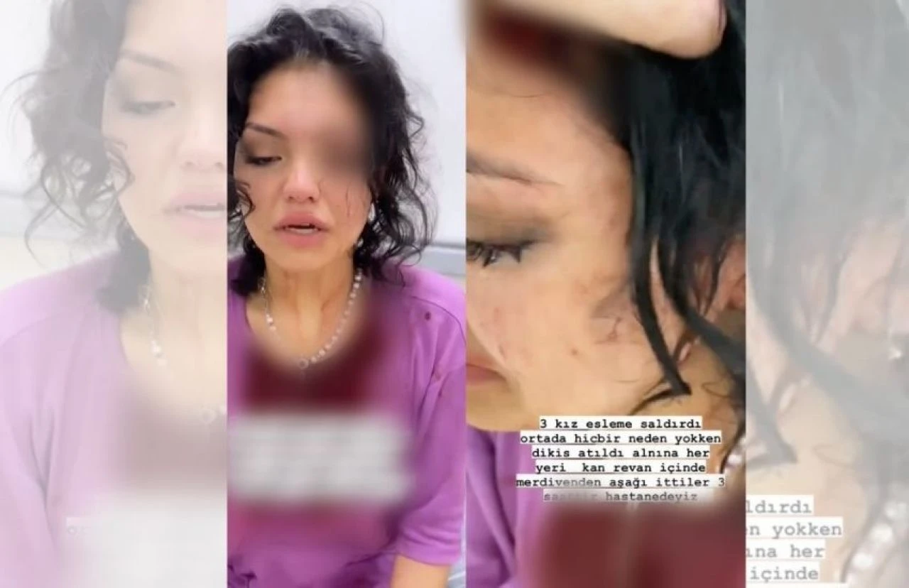 Kısmetse Olur yarışmacısı Eslem Sena saldırıya uğradı! Ölümden döndüğü anları paylaştı