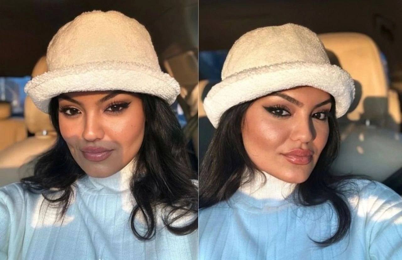 Kısmetse Olur yarışmacısı Eslem Sena saldırıya uğradı! Ölümden döndüğü anları paylaştı