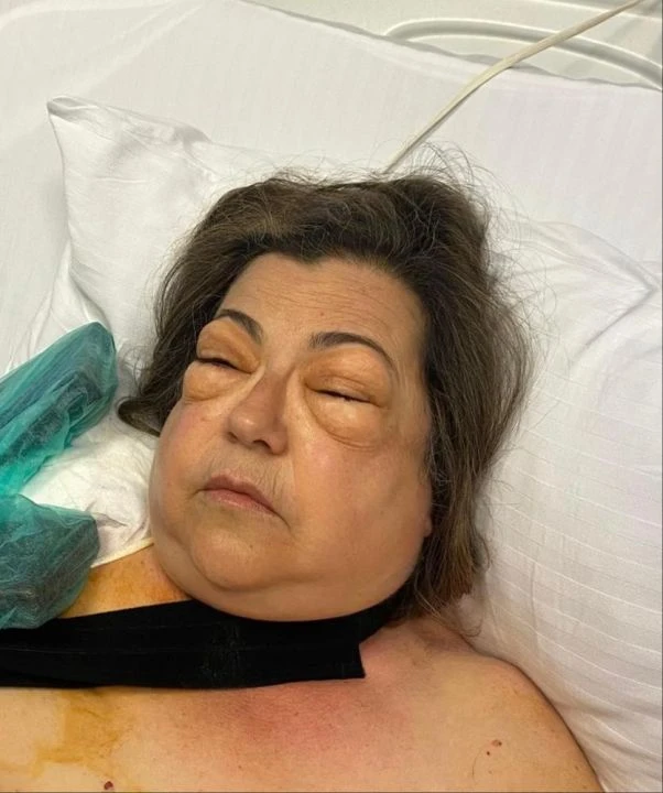 Türkiye'de ilk kez görüldü! Basit bir kusma sandı, hayatından oluyordu