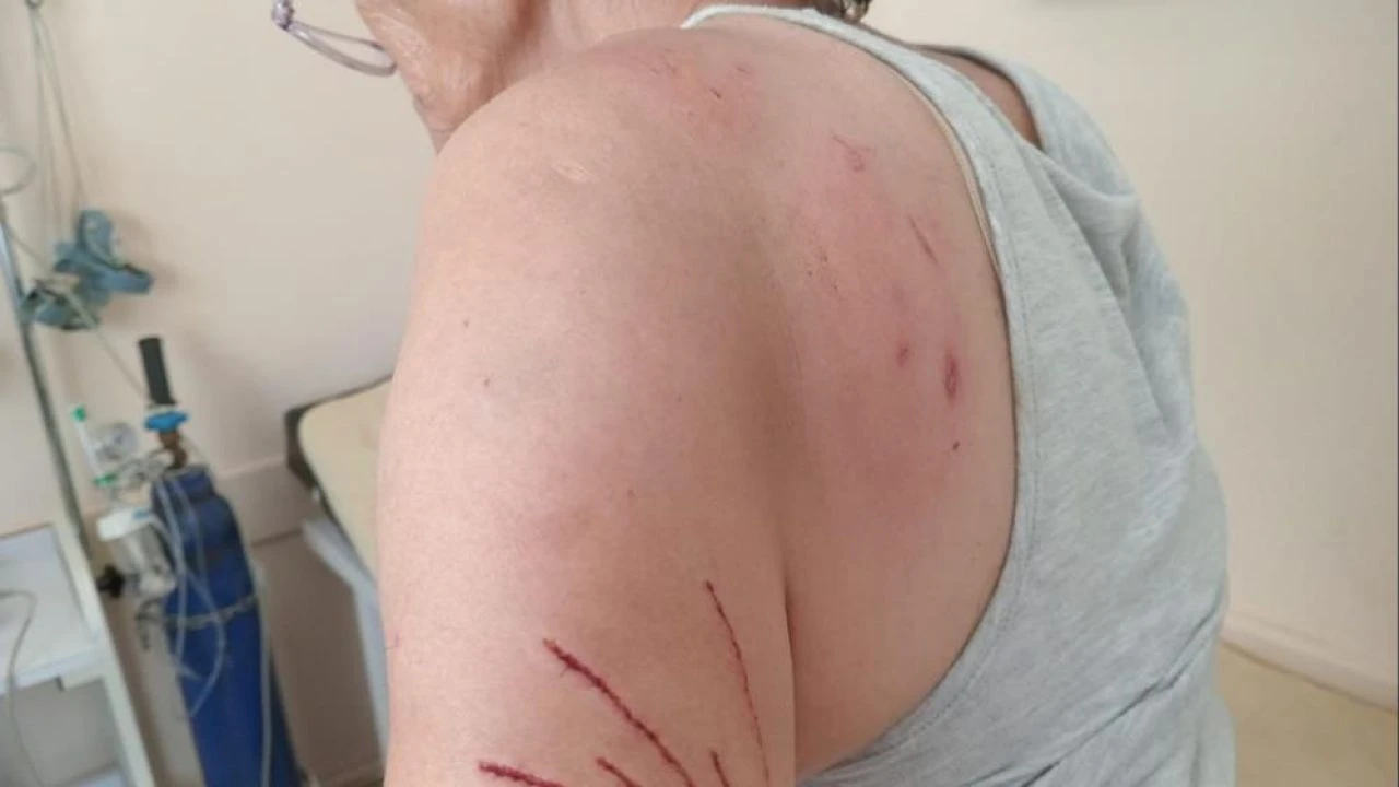 Besledikleri kedi paramparça etti! Evden kan revam çıktılar: Azrail gibiydi! - 1. Resim