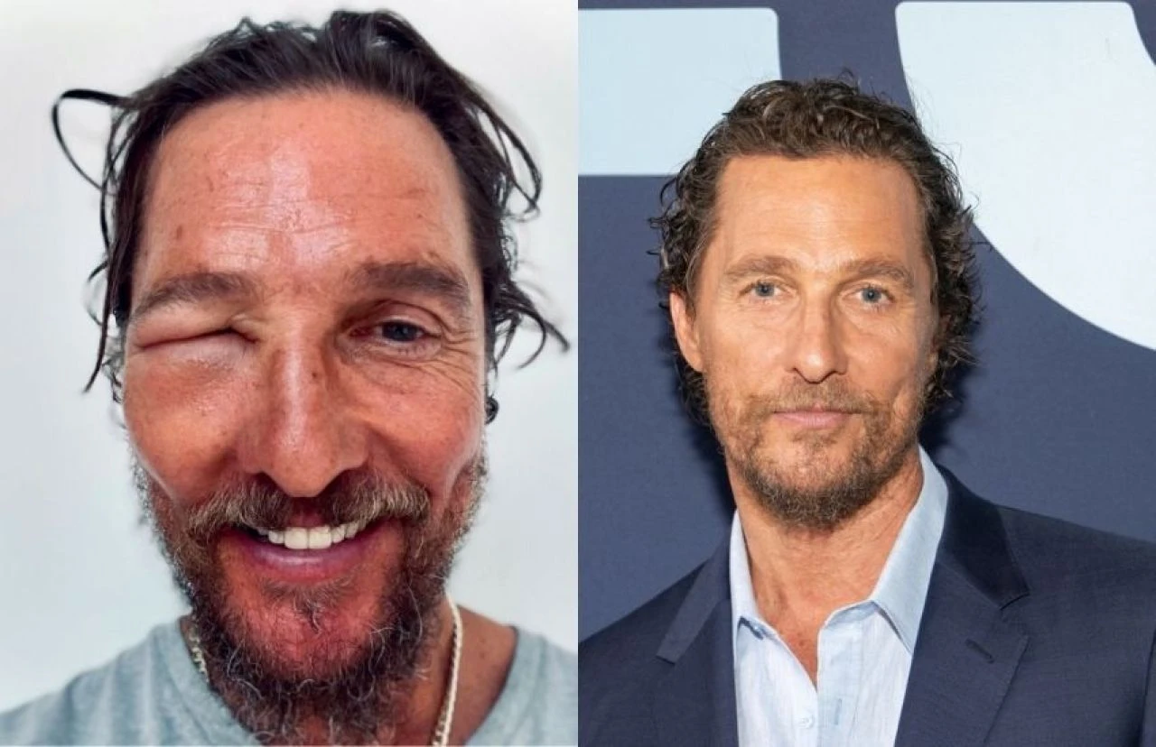 Yıldızlararası oyuncusu Matthew Mcconaughe, tanınmaz halde!