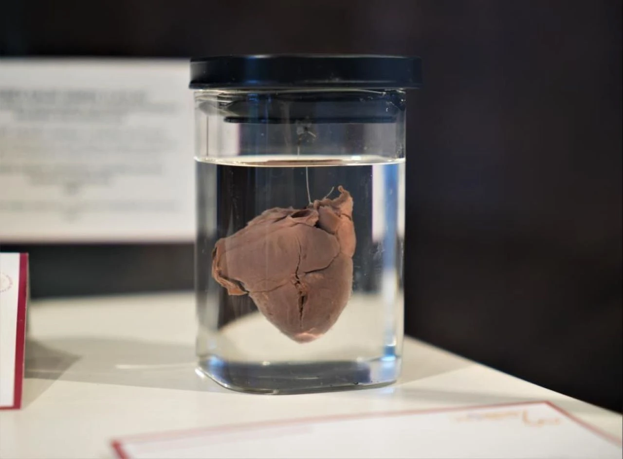 Samsun'da sıradışı müze! Bebek kalplerini sergiliyorlar: Hikayeler çok ilginç...