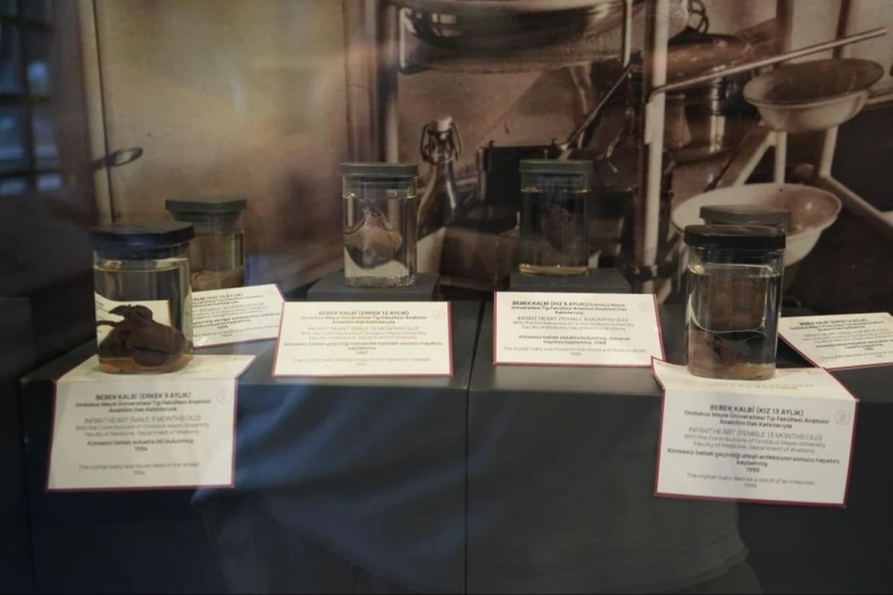 Samsun'da sıradışı müze! Bebek kalplerini sergiliyorlar: Hikayeler çok ilginç...