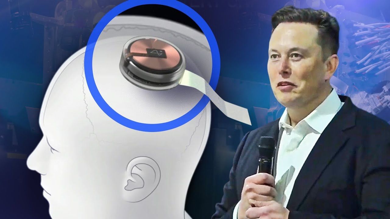 Elon Musk, 2026&#039;ya kadar 1000 kişiye Neuralink çipi takmak istiyor