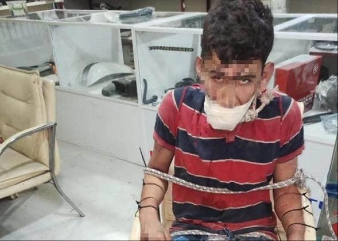 Patrondan çalışana tüyler ürperten işkence! Maaşını isteyince böcek yedirdiler, elektrik verdiler, dişlerini kerpetenle çektiler