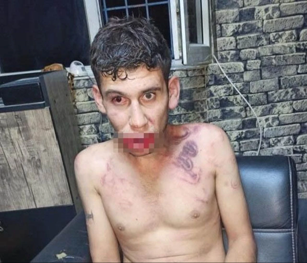 Patrondan çalışana tüyler ürperten işkence! Maaşını isteyince böcek yedirdiler, elektrik verdiler, dişlerini kerpetenle çektiler