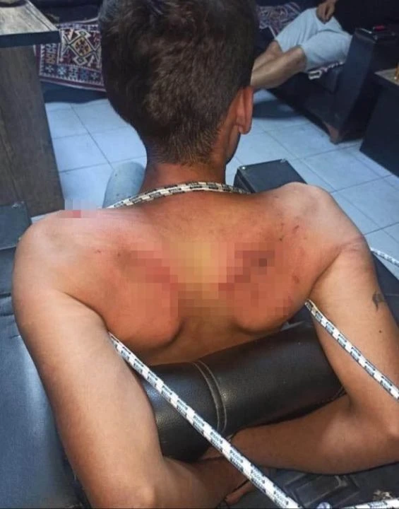 Patrondan çalışana tüyler ürperten işkence! Maaşını isteyince böcek yedirdiler, elektrik verdiler, dişlerini kerpetenle çektiler