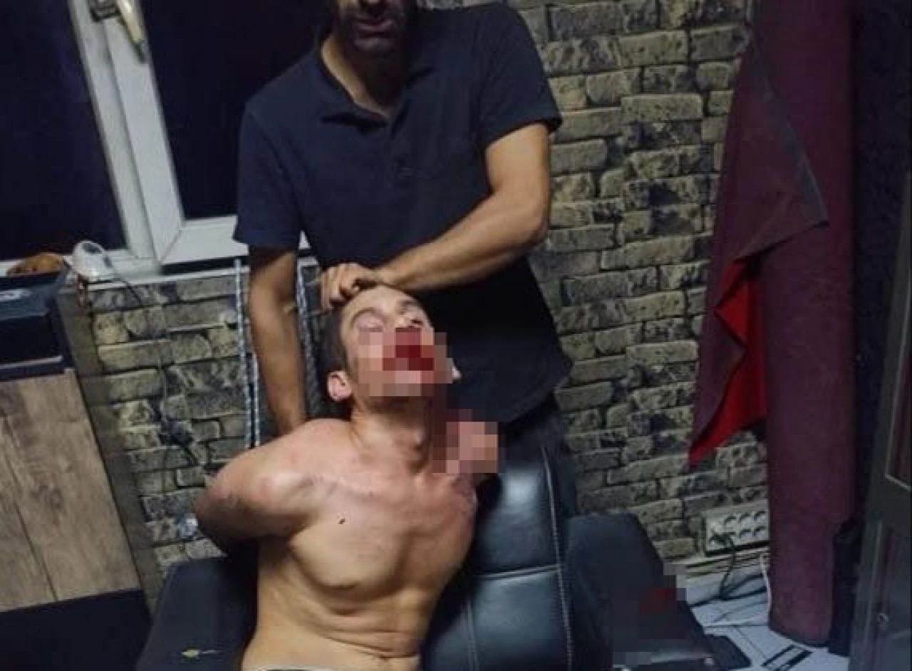 Patrondan çalışana tüyler ürperten işkence! Maaşını isteyince böcek yedirdiler, elektrik verdiler, dişlerini kerpetenle çektiler