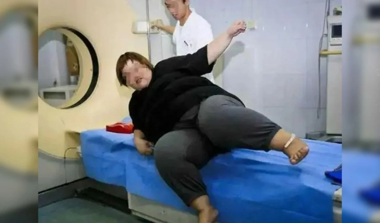 Her gün 10 saat yayın 10 kilo yemek! Genç fenomen canlı yayında hayatını kaybetti - 2. Resim