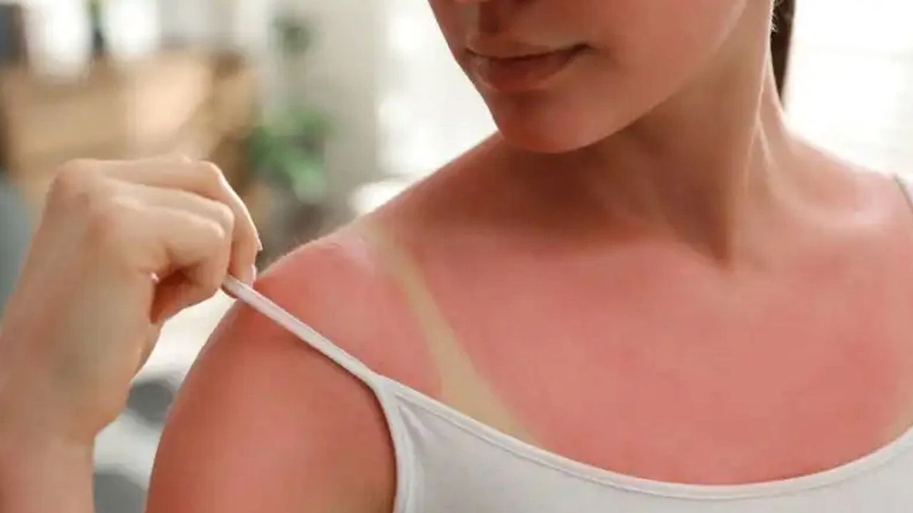 Güneş kremi sürmeden önce bir daha düşünün! Uzmanlar 6 aydan öncesi için uyardı