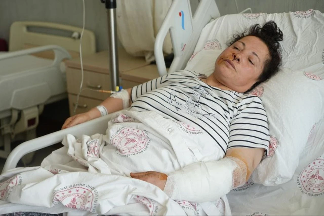 Niğde'de dehşet anları kamerada! Yine başıboş köpek saldırısı: Biri dudağımdan diğeri kolumdan tuttu - 2. Resim