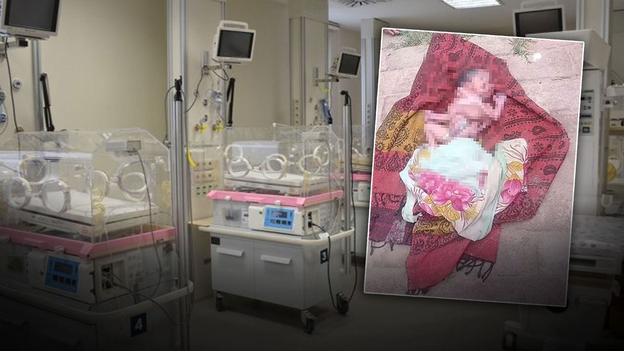 Dört kol, 4 bacak ve 2 yüzle dünyaya gelen bebek şoke etti! Doktorlar sebebini açıkladı - Dünya