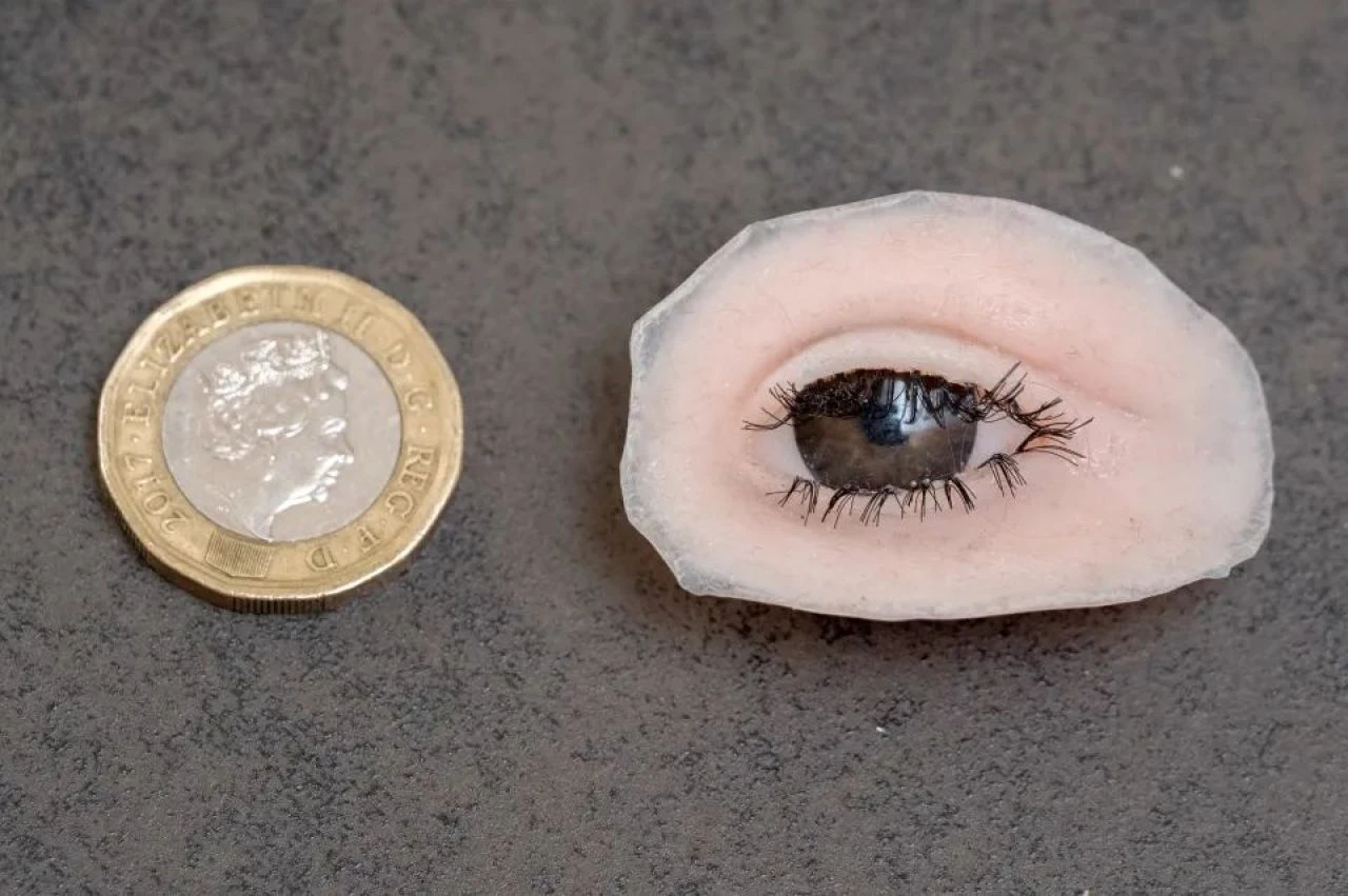 Henüz 10 aylıkken gözü kan çanağına döndü acı gerçek aileyi sarssa da vazgeçmediler - 6. Resim