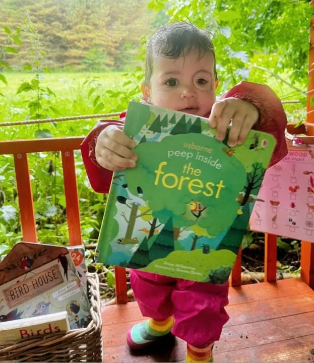 Henüz 10 aylıkken gözü kan çanağına döndü acı gerçek aileyi sarssa da vazgeçmediler - 5. Resim