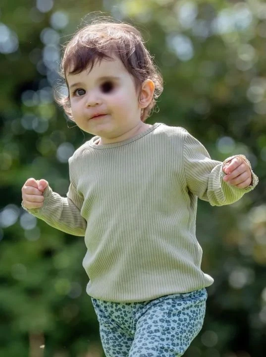 Henüz 10 aylıkken gözü kan çanağına döndü acı gerçek aileyi sarssa da vazgeçmediler - 3. Resim