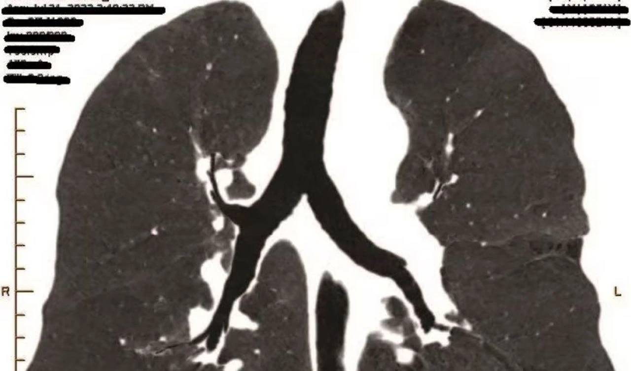 İşi nedeniyle yakalandığı hastalık şirkete 105 milyon TL'ye patladı - 2. Resim