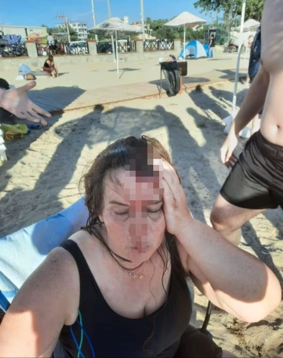Kocaeli'de denizde dehşet anları! Jet ski bir anda geldi, kanlar içinde kaldı - 2. Resim