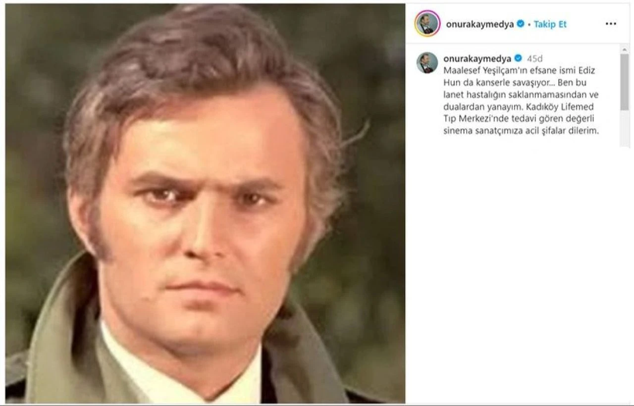 Ediz Hun'dan kötü haber! Kanserle savaşıyor