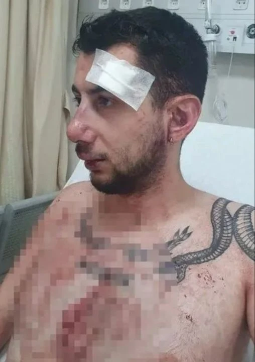 Konya'da muştalı dehşet! Kaburgaları, dişleri, çenesi kırıldı: Saldırgana