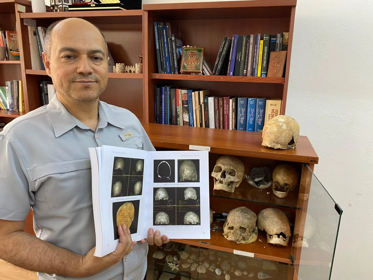 Türkiye'de ilk kez böyle bir kafatasına rastlandı! Üzerine kazılan yazıda bakın ne yazıyormuş - 3. Resim