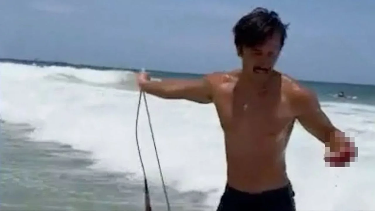 Köpek balığı saldırısından ucuz kurtuldu! Kanlar içinde arabasına binip gitti