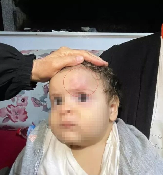 Restoranda darbedilen savcı o anları tek tek anlatı! Kafama yumruk atıldı, bebeğim yere düştü - 5. Resim