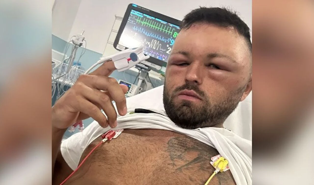 Saç boyası yüzünden korkunç bir hale geldi: Yüzü şişti, gözü kapandı, nefes alamadı