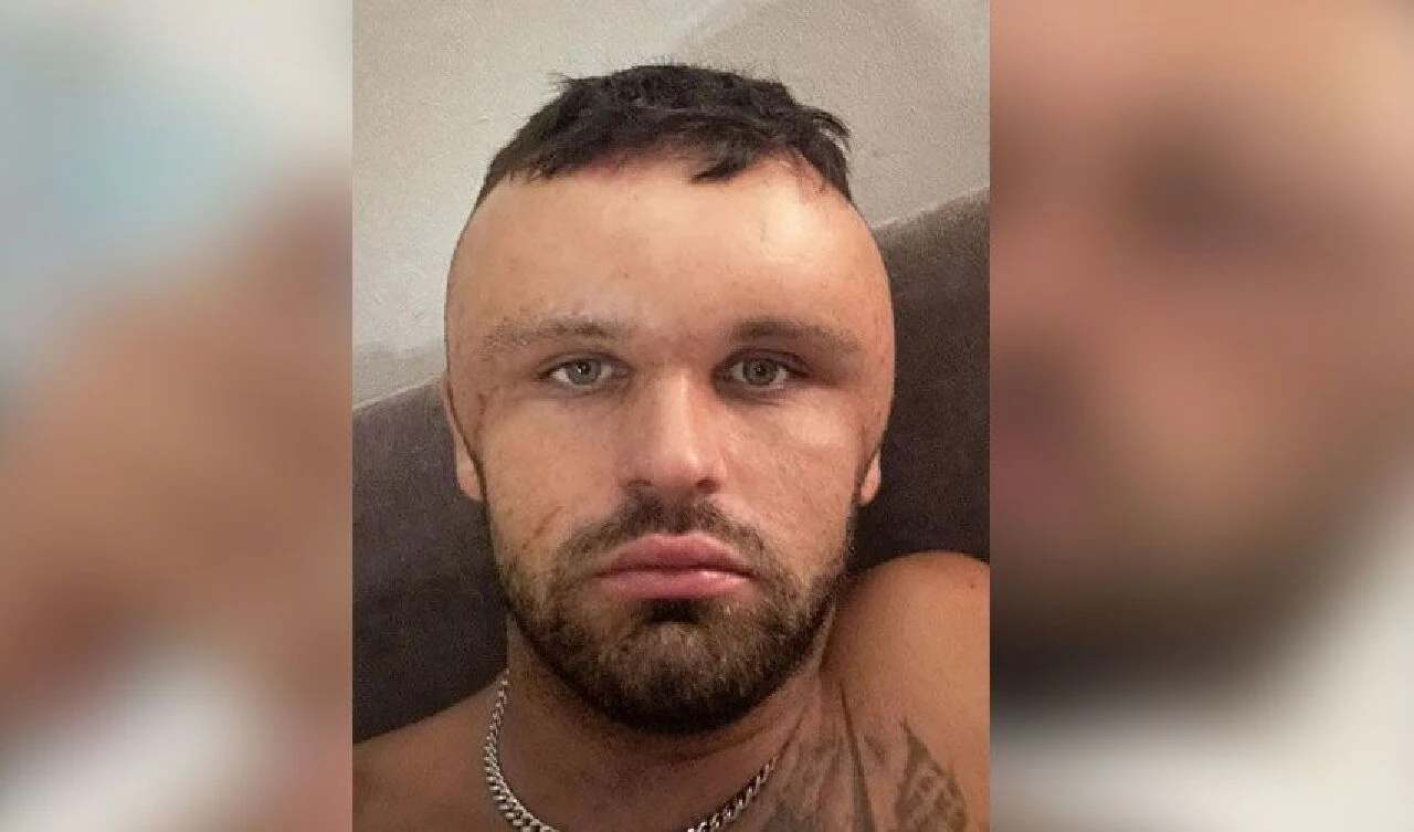 Saç boyası yüzünden korkunç bir hale geldi: Yüzü şişti, gözü kapandı, nefes alamadı