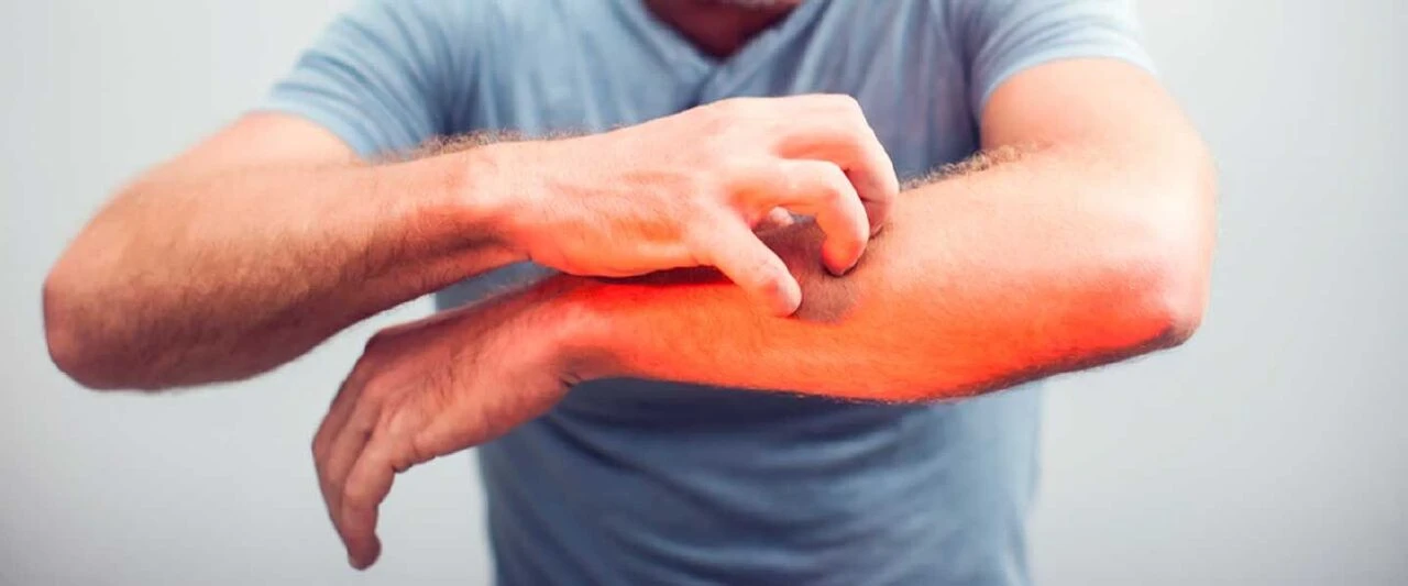 İstanbul'da Asya kaplan sivrisineği alarmı! Megakentte giderek yayılıyor - 3. Resim