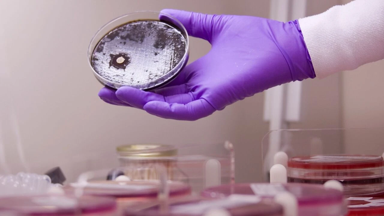 Paris Olimpiyatlarında sporcular tehlike altında! Koli Basili bakterisi alarmı verildi