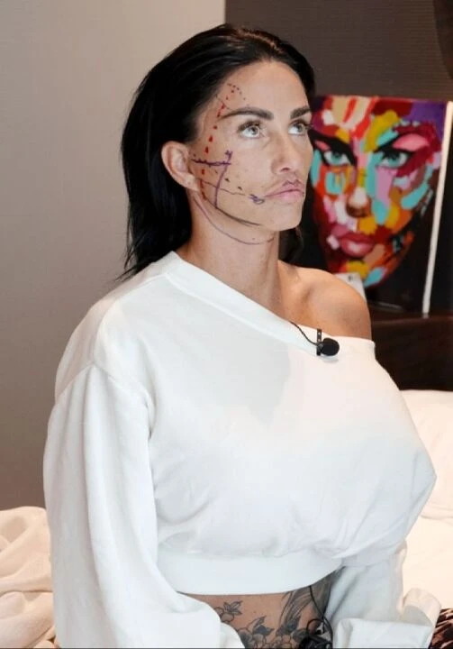 Katie Price gözaltında! Yüzünü gerdirmek için Türkiye'ye gelmişti! - 1. Resim