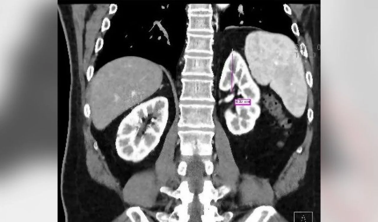 Zorla organ toplama iddiası kanıtlandı! Çin'de kurtulan ilk kişi dehşeti anlattı