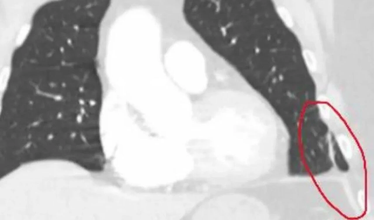 Zorla organ toplama iddiası kanıtlandı! Çin'de kurtulan ilk kişi dehşeti anlattı