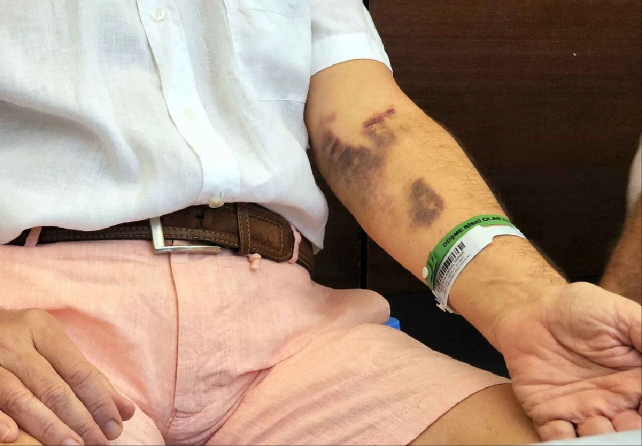 Darbedilen doktor emeklilik kararı aldı! 40 yıllık tecrübe, mesleğe küstü - 3. Resim