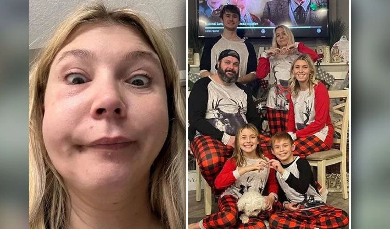 Kendisini balon balığı gibi şişiren hastalık 11 yıl sonra fark edildi! Ölümcül riski de var - 3. Resim