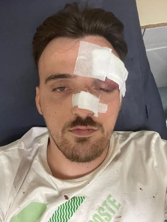 İstanbul'da maganda dehşeti: Önce küfretti, sonra dövdü, yetmedi aracıyla üstünden geçti