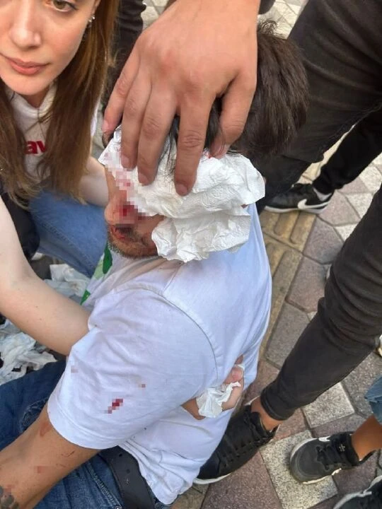 İstanbul'da maganda dehşeti: Önce küfretti, sonra dövdü, yetmedi aracıyla üstünden geçti